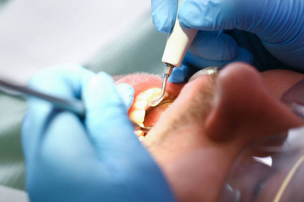 Best Emergency Broken Tooth Repair in Negaunee, MI
